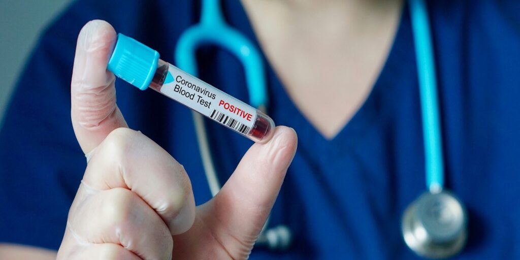 Κορωνοϊός: Και πάλι πάνω από 500 τα νέα κρούσματα στη Λάρισα – 6.808 σε όλη τη χώρα, 42 νέοι θάνατοι