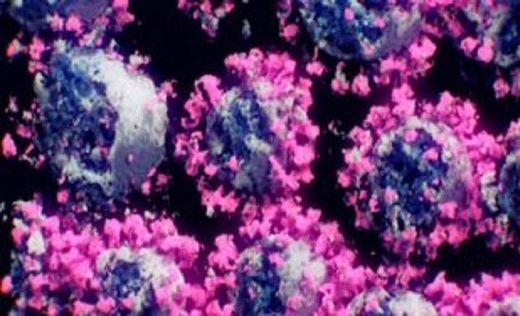 Παγκόσμια ανησυχία για την παραλλαγή Όμικρον